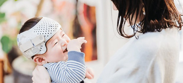 赤ちゃんの頭のかたち外来